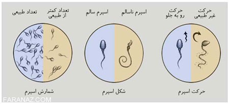 همه چیز درباره تست یا آزمایش اسپرم و آنالیز آن