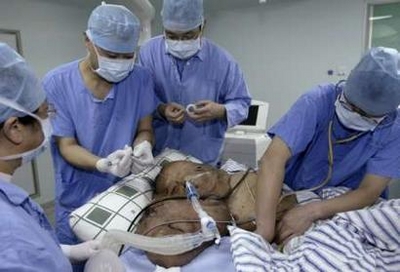 زشت ترین مرد دنیا را ببینید!!! (عکس18+)