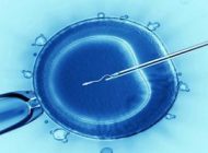 آشنایی با روش IVF (آی وی اف) برای درمان ناباروری خانمها