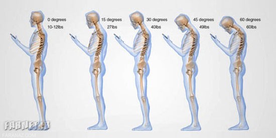مضرات استفاده بیش از اندازه موبایل هوشمند برای سلامتی