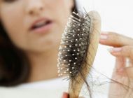 پیشگیری از ریزش مو بر اثر مصرف قرص ضد بارداری