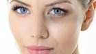 حلقه های تیره زیر چشم ها را چگونه بهبود ببخشیم ؟