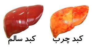 زهر‌زدایی کبد چرب با روغن زیتون و آب لیمو