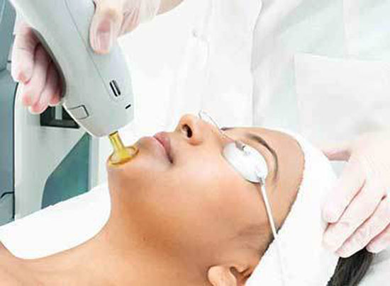 لیزر کردن موهای زائد مفید است یا مضر لیزر کردن موهای زائد مفید است یا مضر