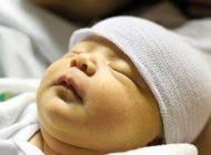 همه چیز درباره بیماری زردی نوزادان + درمان خانگی زردی نوزاد