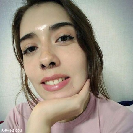 اکستنشن موی بینی جدیدترین مد این روزها + عکس اکستنشن موی بینی جدیدترین مد این روزها + عکس