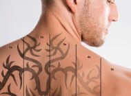 همه چیز در رابطه با خالکوبی(تتو) و بهترین روش برای پاک کردن آن