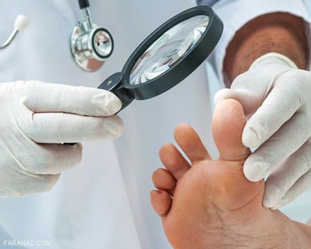 همه چیز درباره ی تاول وپینه پا و راهکارهای درمانی آن همه چیز درباره ی تاول وپینه پا و راهکارهای درمانی آن