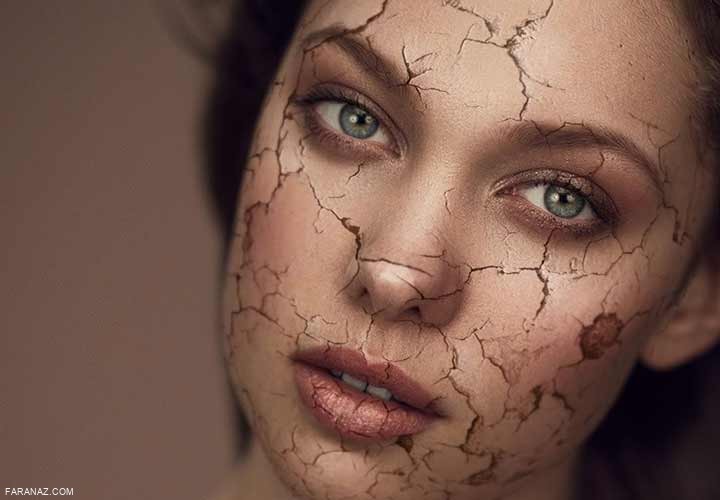 نوع پوست خود را چگونه تشخیص دهیم ؟