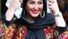 عکس های لو رفته و داغ قبل و بعد عمل زیبایی بازیگران زن ایرانی