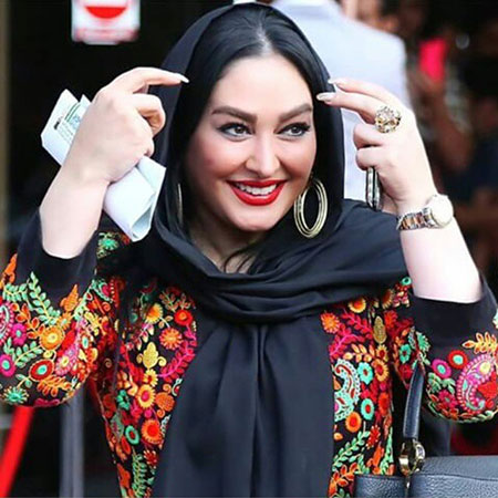 عکس های لو رفته و داغ قبل و بعد عمل زیبایی بازیگران زن ایرانی عکس های لو رفته و داغ قبل و بعد عمل زیبایی بازیگران زن ایرانی