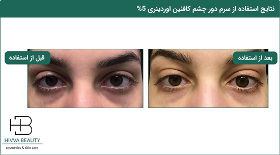 اوردینری را در روتنی پوستی خود حتما جای دهید